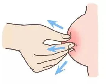 大乳頭、小乳頭、扁平乳頭、凹陷乳頭3大喂養(yǎng)指導及護理指南！