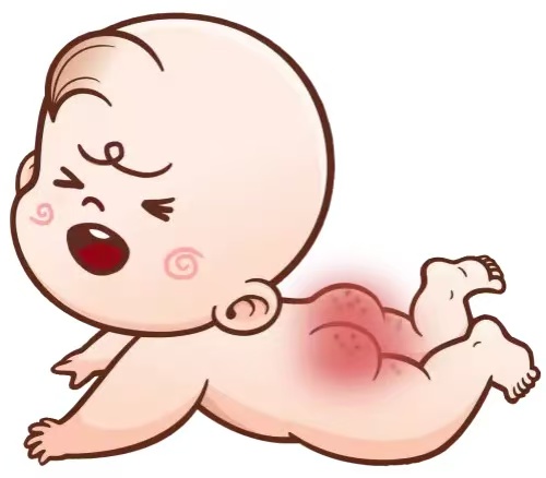 預(yù)防寶寶紅屁股四大實用技巧  